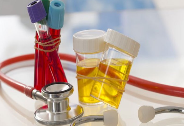 Cách đọc 10 thông số trong xét nghiệm tổng phân tích nước tiểu 2