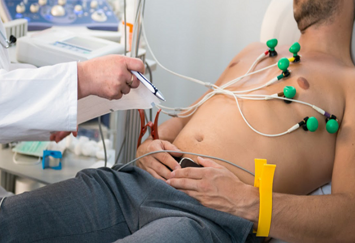 Cách mắc điện tim, gắn điện cực cho máy đo điện tim 3