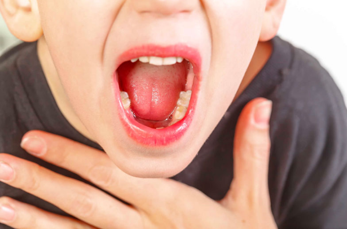 Cảm giác nghẹn cổ họng nhưng ăn uống bình thường 2