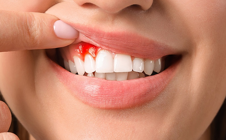 Can thận âm hư là gì? Có nguy hiểm cho sức khỏe không? 4