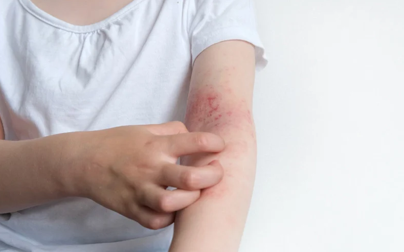 Cây đuôi chồn có tác dụng gì đối với sức khỏe? Liều dùng và cách dùng 2