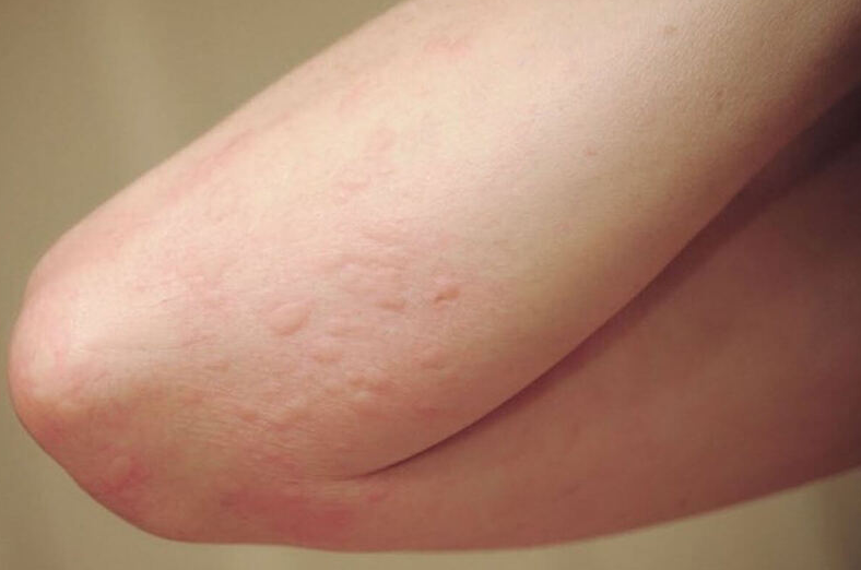 Chanh dây vàng và chanh dây tím có gì giống và khác nhau? 4