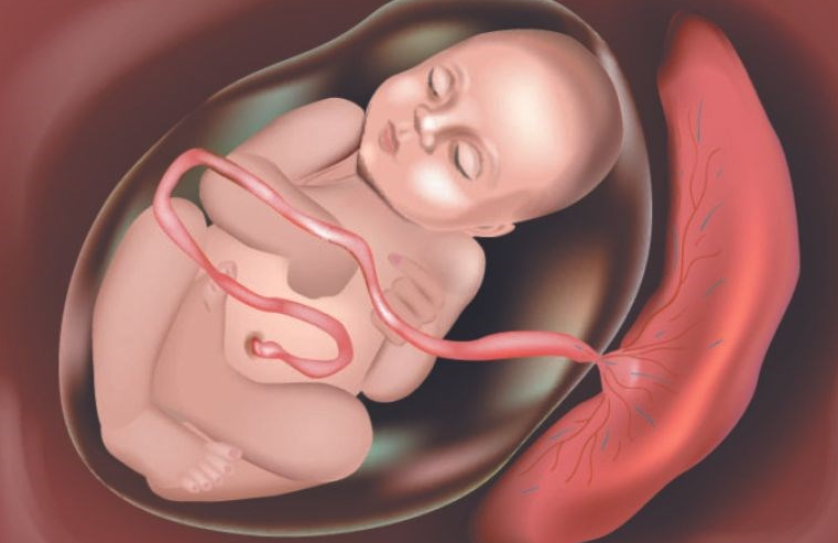 Có phát hiện được rau cài răng lược trên siêu âm không? 1