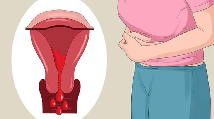 Có phát hiện được rau cài răng lược trên siêu âm không? 2