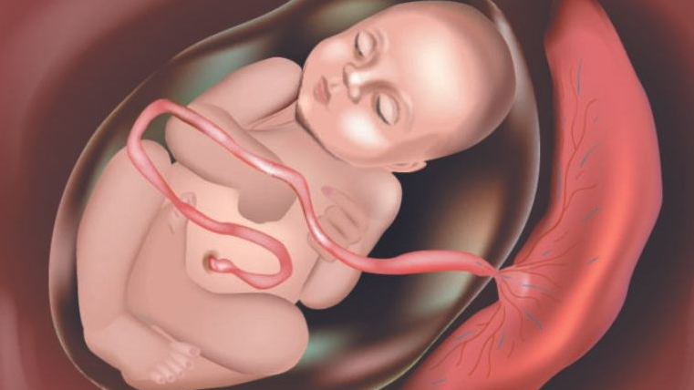Hien Rau Có phát hiện được rau cài răng lược trên siêu âm không?