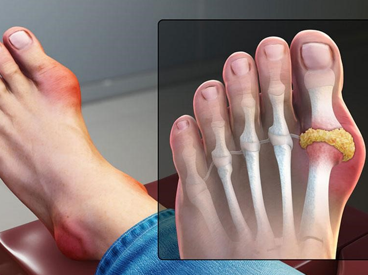 Cua đồng: Thành phần dinh dưỡng, công dụng, lưu ý khi ăn 3