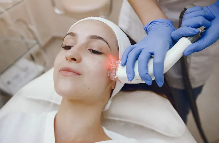 Điều trị chàm bằng laser toning và những điều cần biết 3