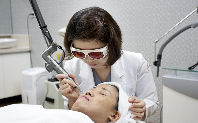 Điều trị chàm bằng laser toning và những điều cần biết 4