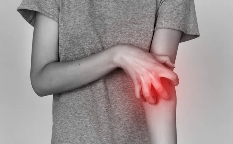 Gan nhiễm mỡ gây ngứa không? Cách cải thiện gan nhiễm mỡ khi bệnh gây ngứa 1