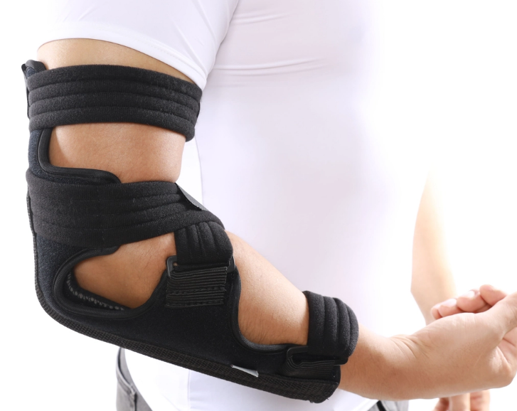 Gãy chỏm xương quay là do đâu? Cách điều trị thế nào? 4