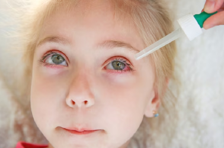 Giải đáp: Đau mắt đỏ ở trẻ em có nguy hiểm không? 2