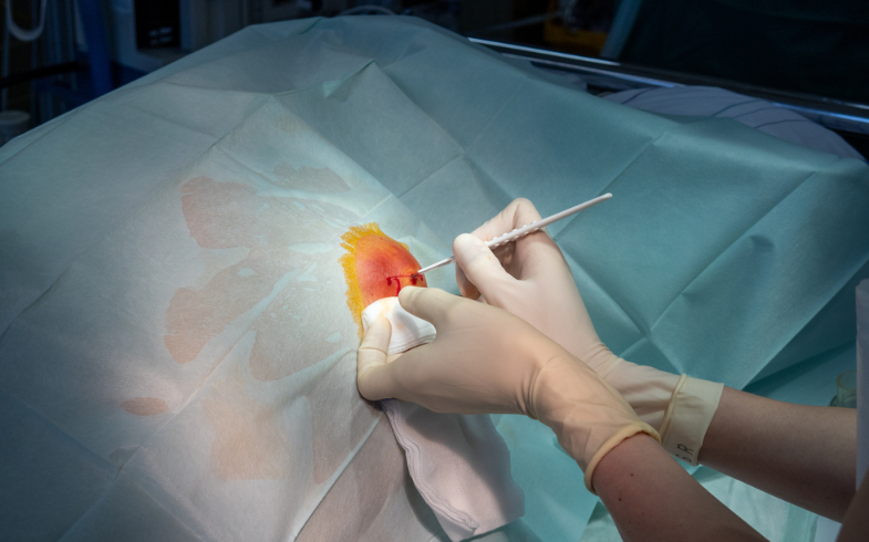 Giải đáp: Tắc tia sữa bao lâu thì bị áp xe? 3