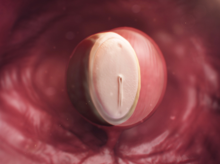 Giải đáp: Thai 4 tuần siêu âm có thấy không? 1