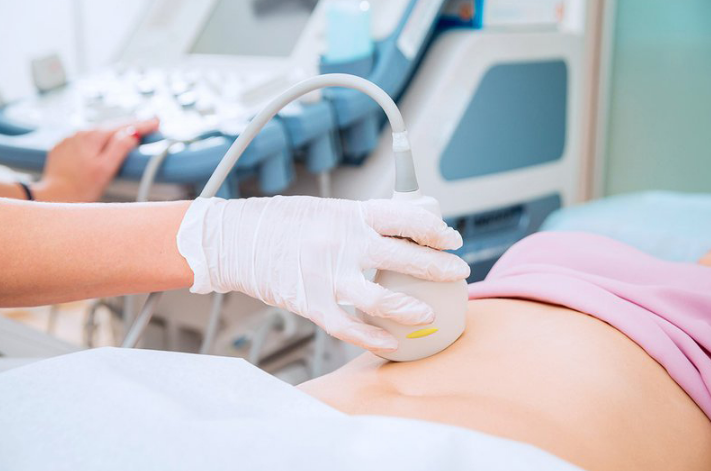 Giải đáp: Thai 9 tuần siêu âm bụng hay đầu dò? 3