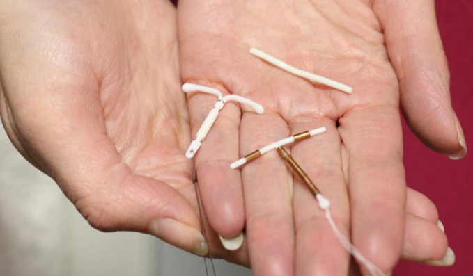 Giải đáp: Viêm lộ tuyến có đặt vòng được không? 1