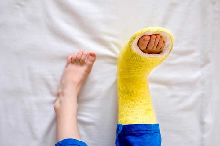 Hội chứng đường hầm cổ chân và những điều cần biết 5