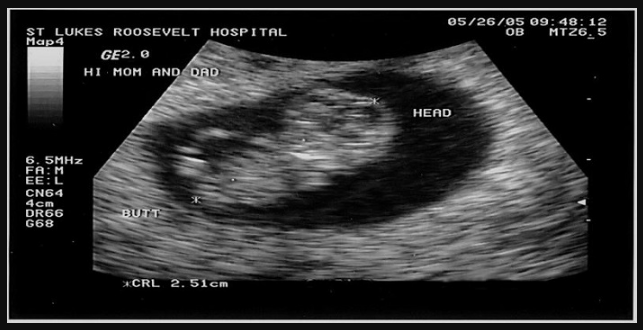 Khi siêu âm thai 9 tuần, mẹ bầu cần biết thông tin gì? 3