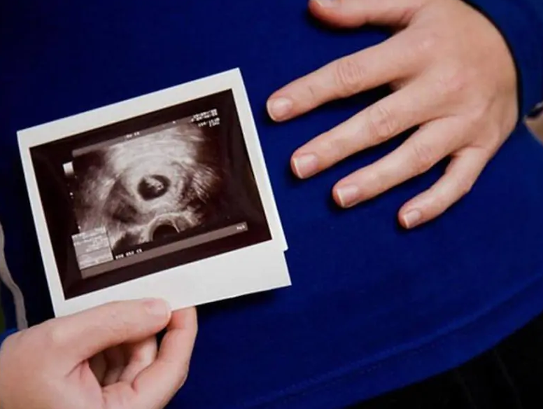 Mách mẹ cách nhận biết dấu hiệu thai 6 tuần khỏe mạnh 2