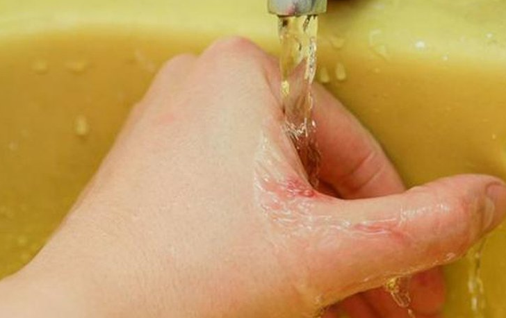 Mèo cào có sao không và cách xử lý khi bị mèo cào? 2