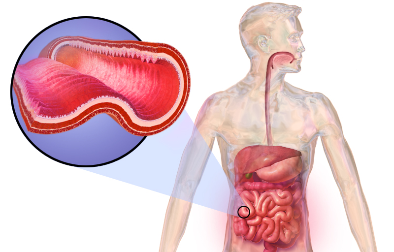 Mổ đại tràng​ và những biến chứng sau mổ cần lưu ý 2