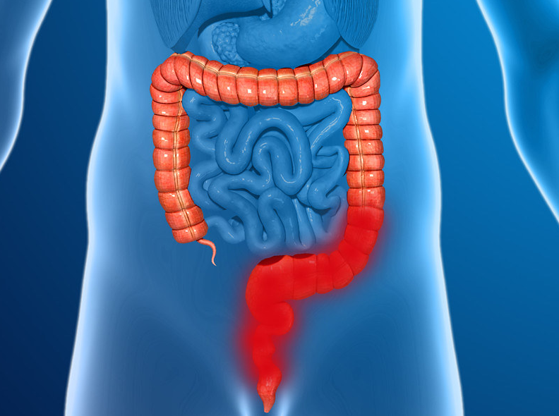 Một số bệnh về đường tiêu hóa thường gặp và lợi ích của việc khám sàng lọc 1
