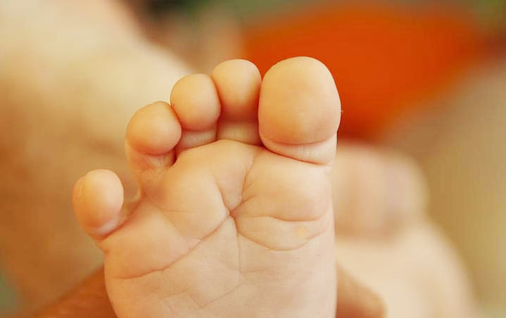 Phù tay chân do nguyên nhân gì? Khi nào cần đi khám bác sĩ? 5