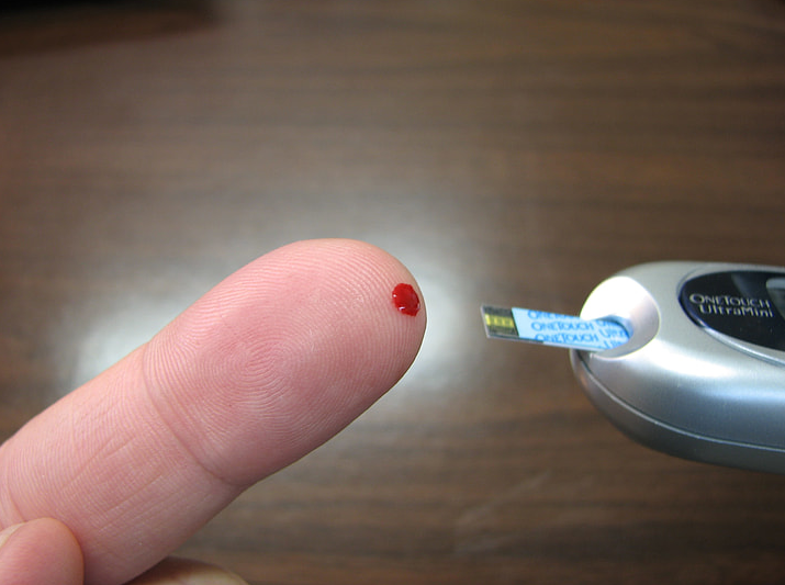 Quy trình chăm sóc bệnh nhân chạy thận nhân tạo tại nhà và những điều cần lưu ý 3