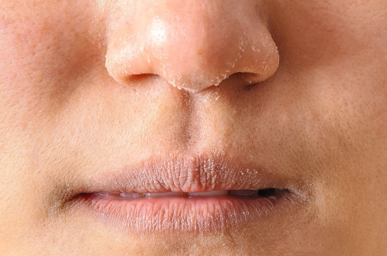 Serum phục hồi da có tác dụng gì? Ai nên dùng serum phục hồi da? 2