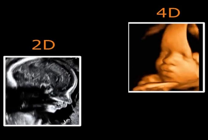 Siêu âm 2D và 4D cái nào chính xác hơn? Siêu âm 2D và 4D khác nhau thế nào? 2