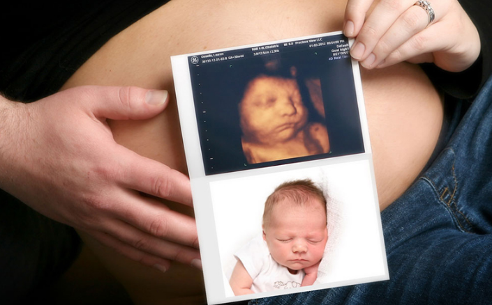 Siêu âm 2D và 4D cái nào chính xác hơn? Siêu âm 2D và 4D khác nhau thế nào? 4