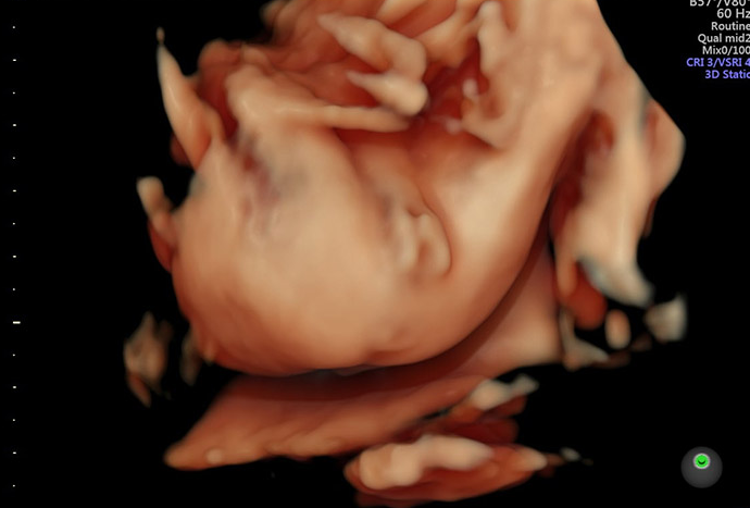 Siêu âm con gái hay khép chân có đúng không? 2