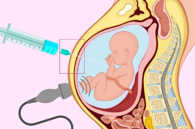 Siêu âm con gái hay khép chân có đúng không? 3