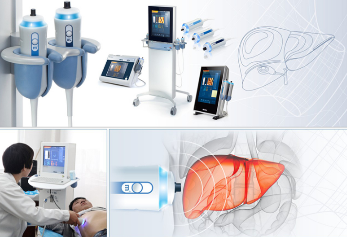 Siêu âm đàn hồi mô gan có phát hiện tình trạng xơ gan? 4