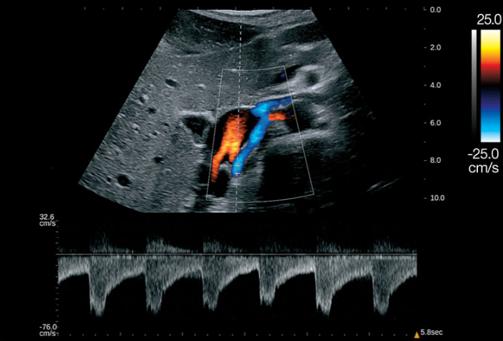 Siêu âm Doppler màu là gì? Được ứng dụng trong các trường hợp nào? 3
