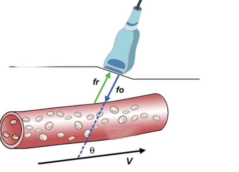 Siêu âm Duplex là gì? Có thể phát hiện được những bệnh gì? 4