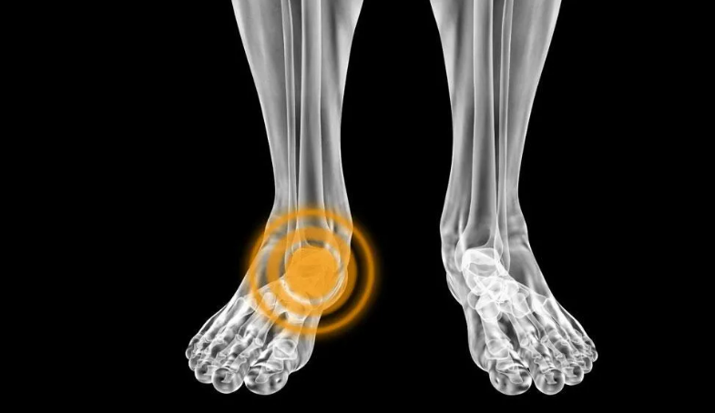 Siêu âm khớp cổ chân là gì? Được thực hiện khi nào và quy trình ra sao? 3