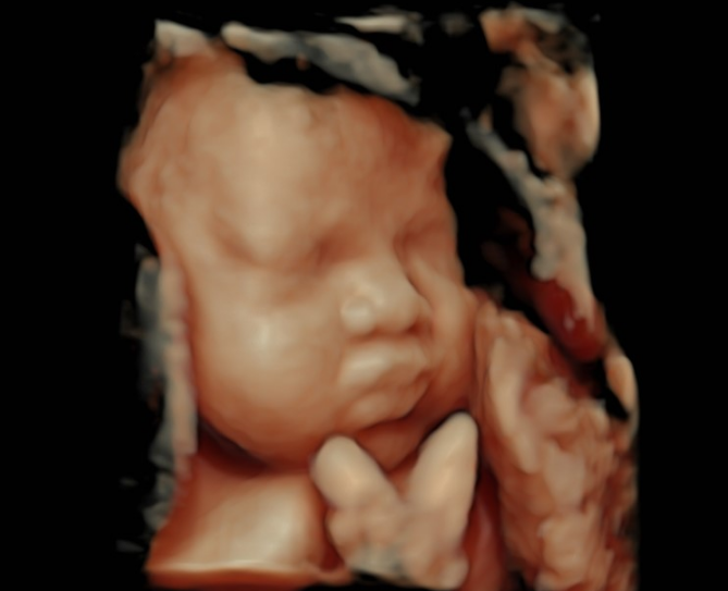 Sự khác nhau giữa siêu âm 2D 3D 4D 5D là như thế nào? 3