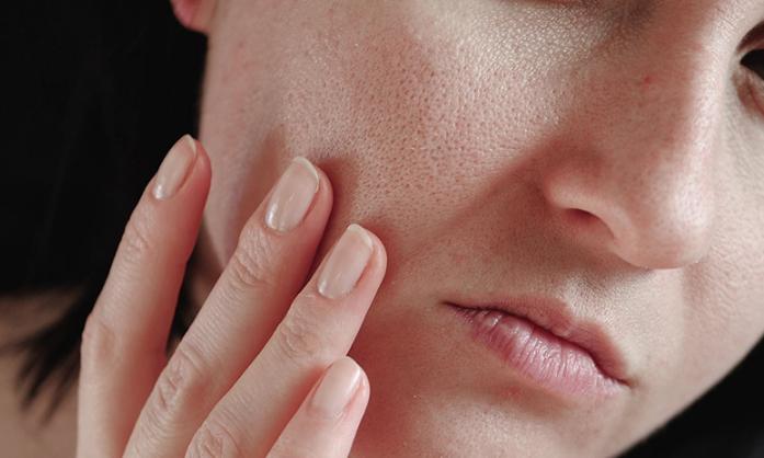 Sữa rửa mặt Cetaphil cho da khô có tốt không? 1