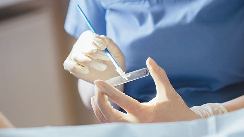 Thế nào là pap smear? Vì sao phụ nữ cần xét nghiệm pap smear? 1