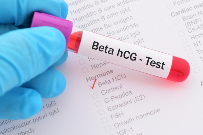 Thử que 2 vạch xét nghiệm máu không có thai: Làm gì khi gặp phải tình huống này? 4