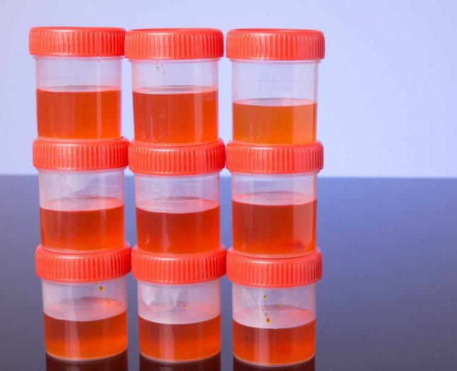 Tiểu ra máu ở nam giới là gì, có nguy hiểm không? 1