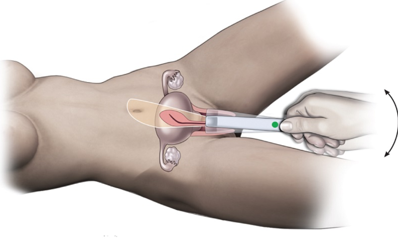 Tim thai tuần 7 bao nhiêu là bình thường? 3