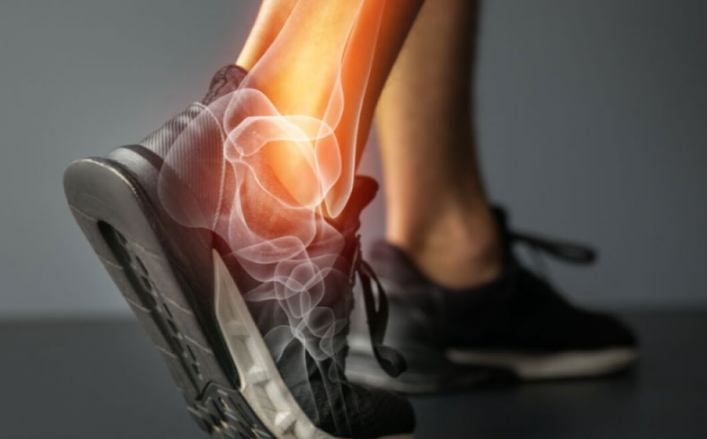 Tràn dịch khớp cổ chân là bệnh lý gì? 2 Có nguy hiểm không? 2