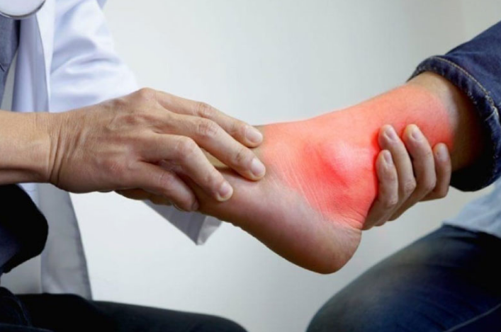 Tràn dịch khớp cổ chân là bệnh lý gì? Có nguy hiểm không? 3