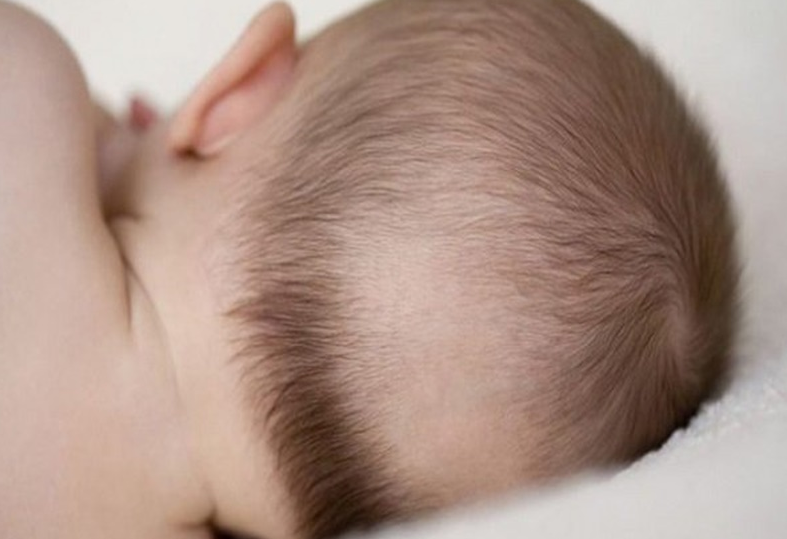 Trẻ nhỏ bị rụng tóc vành khăn có nguy hiểm không? 1