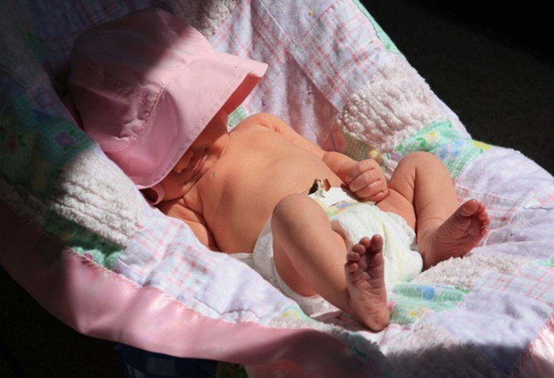 Trẻ nhỏ bị rụng tóc vành khăn có nguy hiểm không? 3