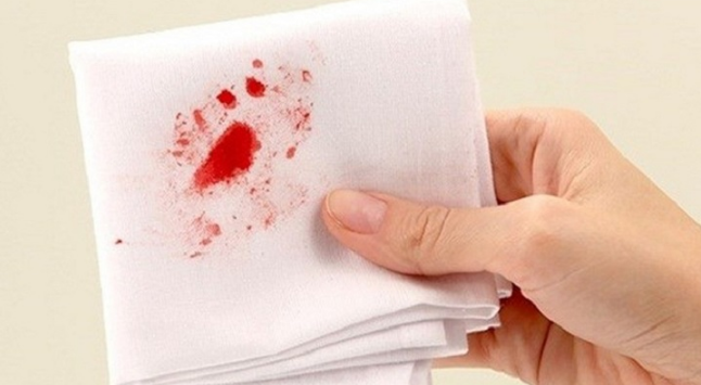 Trĩ hỗn hợp: Nguyên nhân, triệu chứng và cách điều trị 2