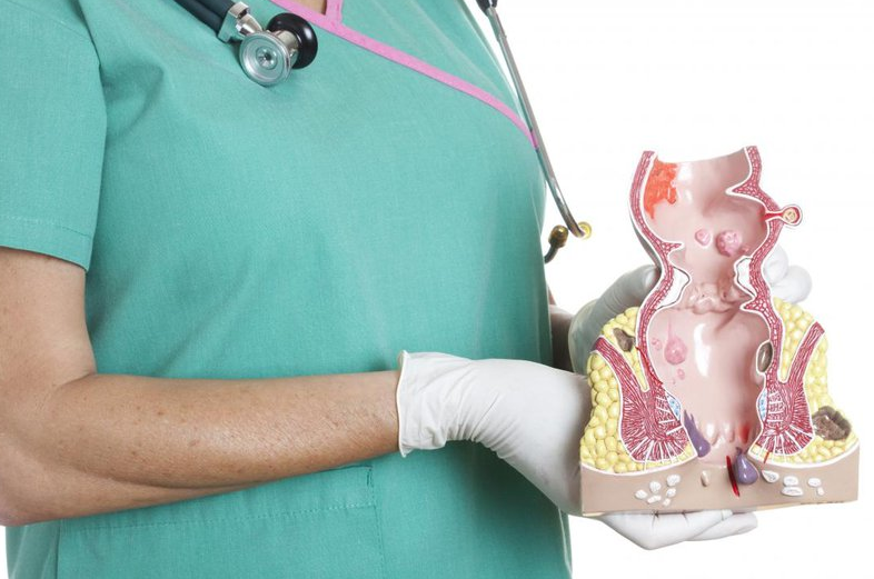 Trĩ ngoại tắc mạch là gì? Có nguy hiểm không và cách điều trị thế nào? 1