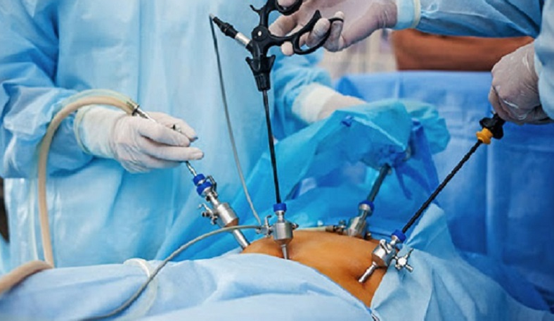 U cơ tuyến túi mật: Nguyên nhân, triệu chứng, chẩn đoán và điều trị 3