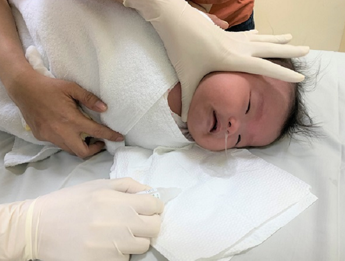 Vật lý trị liệu hô hấp nhi là gì? Quy trình thực hiện ra sao? 3